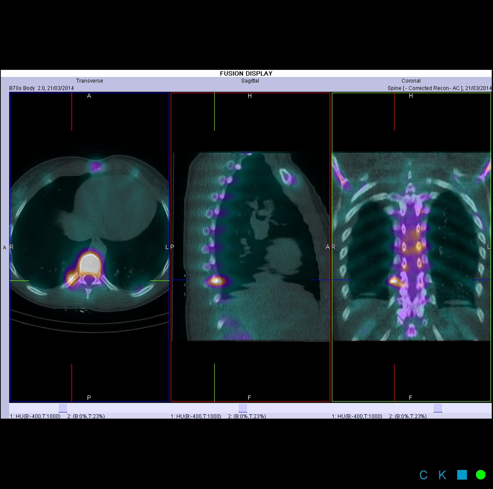 Dr iain duncan image gallery nuclear medicine